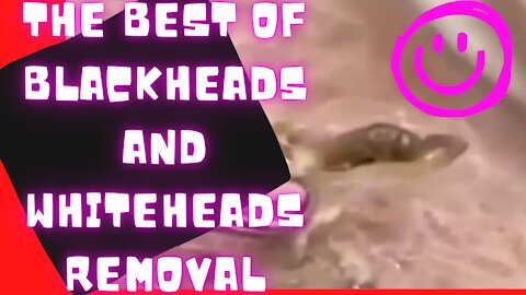 CARNATIONS AND THORNS SATISFYING- BEST BLACKHEADS AND WHITEHEADS