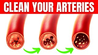 A Foolproof Recipe To Reduce Your Cholesterol And Triglycerides Naturally