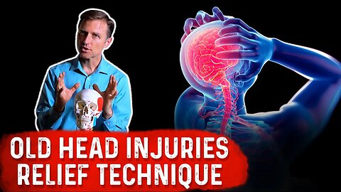 Head Injury and Concussion? Do This Acupressure for Head Trauma – Dr. Berg