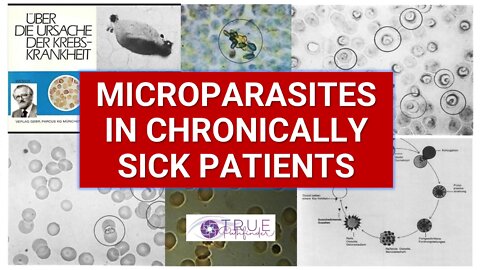 VIDEO PROOF: MICROPARASITES CAUSE CHRONIC DISEASE | TRUE PATHFINDER