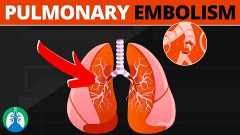 Pulmonary Embolism (Medical Definition) | Quick Explainer Video