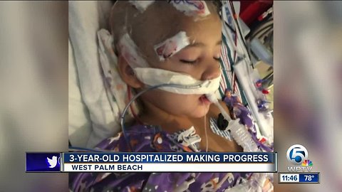 Family says Port St. Lucie child making progress after being shot during road-rage incident