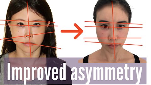 How I improved my facial symmetry