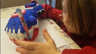 Fem år gammel gutt lager 3D-protese for funksjonshemmede barn