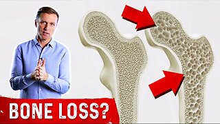 Does Keto Cause Bone Loss?
