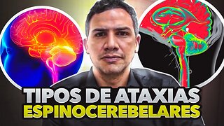 Ataxia Espinocerebelar - Tipos de Ataxias Espinocerebelares