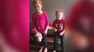 Brother Pulls His Sister's Loose Tooth Without Warning