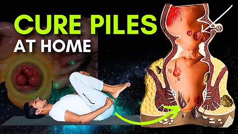 Piles Problem Treatment Part 1| Yoga for Piles | Cure Hemorrhoids with Simple Exercises #piles