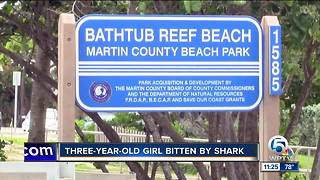 3-year-old girl bitten by shark in Martin County