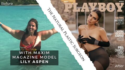 From 300 Pounds To Playboy! | The Natural Plastic Surgeon