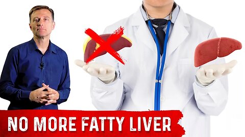 Amazing Fatty Liver Success Story: Dr. Berg