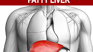 6 Natural Foods To Say Goodbye To Fatty Liver
