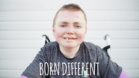 The Man Whose Skin Falls Off | BORN DIFFERENT