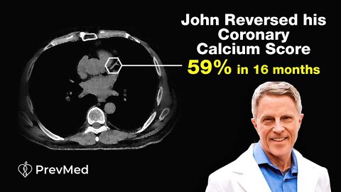 How He Reversed his Coronary Calcium Score by 59% in 6 Months