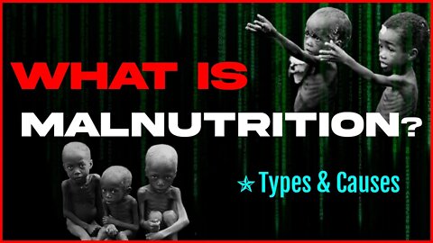 What is Malnutrition? Types & Causes