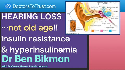 BEN BIKMAN 1 | HEARING LOSS…not old age!! insulin resistance & hyperinsulinemia