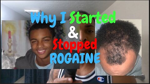 Why I stopped Rogaine after 6 months at 22|What happens after you stop? #stoppingrogaine #hairgrowth