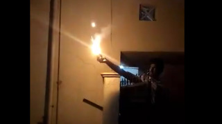 Firecracker held in hand goes wrong
