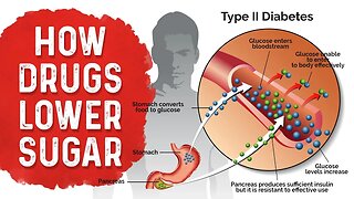 Diabetes Medication Side Effects: Metformin, Sulfonylurea & Insulin – Dr.Berg