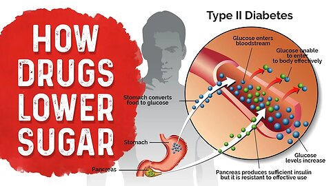 Diabetes Medication Side Effects: Metformin, Sulfonylurea & Insulin – Dr.Berg