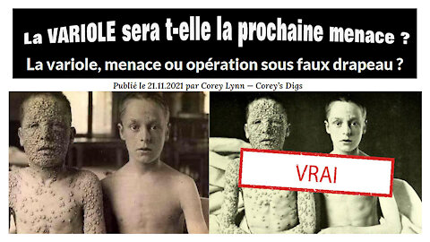 VACCINS / Aprés le Covid...La Variole ? (Hd 1080) Lire descriptif