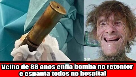 Velho de 88 anos enfia bomba no retentor e espanta todos no hospital