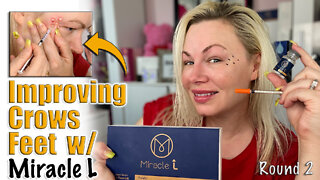 Improving Crows feet with Miracle L from AceCosm.com | Code Jessica10 Saves you Money!