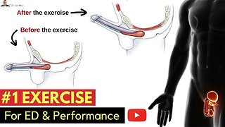 Exercise For Preventing Erectile Dysfunction & Improving Your Performance In The Bedroom