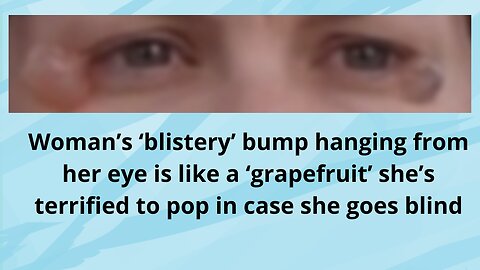 The woman is afraid to pop the "blistery" bulge that hangs from her eye