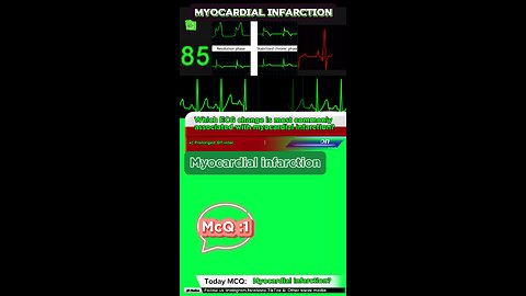 3rd Degree AV Heart Block #MedicalEducation #HeartRhythm #CardiacConduction #ClinicalScenarios