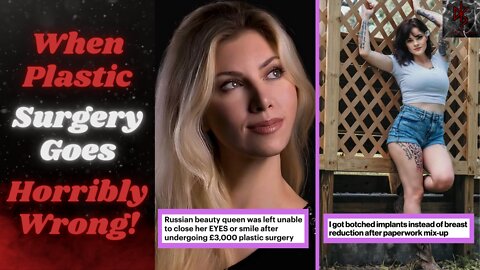 Plastic Surgery Gone Wrong: Russian Beauty Queen Can't Move Face, Breast Reduction Becomes Implants