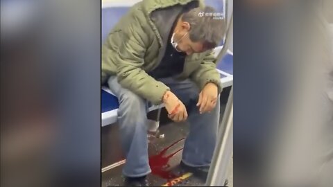 Anti-Asian Attack on NY Subway Leaves Man Gushing Blood
