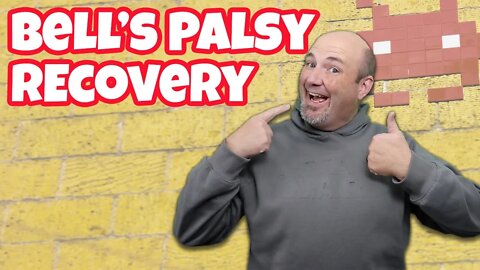 Recovery and Side Effects of Bells Palsy - 1 Year Later