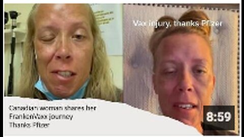 Canadian Woman shares her horrific FrankenVaxx journey (1 year updates)