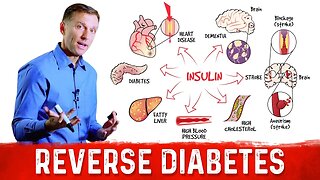 How to Reverse Damage from Diabetes? – Dr.Berg on Reversing Diabetes