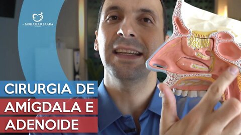 Houve indicação de Cirurgia de Amigdala e Adenoide? Saiba tudo aqui