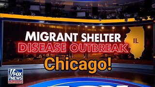 Chicago migrant centers facing tuberculosis, measles cases
