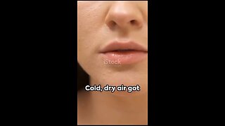 Ways to stop your lips from getting dry