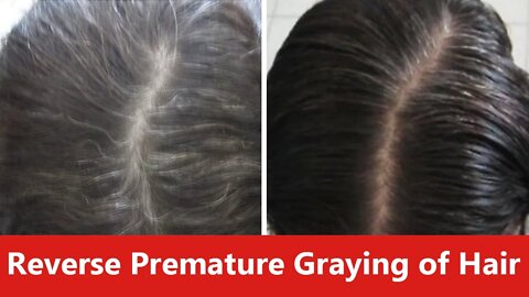 How to Reverse Premature Graying of Hair Naturally