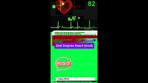 Second degree heart blockages #2nddegreeheartblock #arrthymias #CardiacArrhythmia