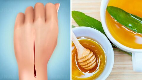 How to Heal Cuts and Wounds Faster