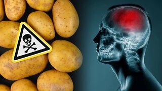 These Foods Bring Your Brain Down Without You Knowing