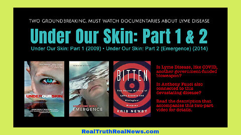 🕷️ 🪲 Documentary: "Under Our Skin ~ The Untold Story of Lyme Disease" Parts 1 and 2 ⭐ Info and Treatment Links Below 👇