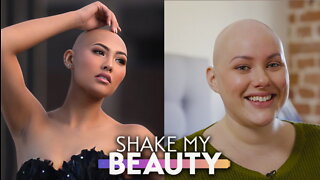 We're Bald And Beautiful | SHAKE MY BEAUTY