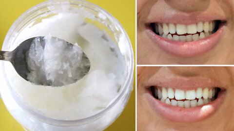 Say Goodbye to Oral Health Problems with This Natural Remedy