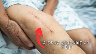 A Scar Screams Look At Me