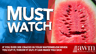 If You Ever See Cracks In Your Watermelon When You Cut It, Throw It Out. It Can Make You Sick