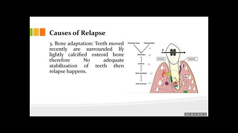 Orthodontics L22 (Retention & Relapse 1)