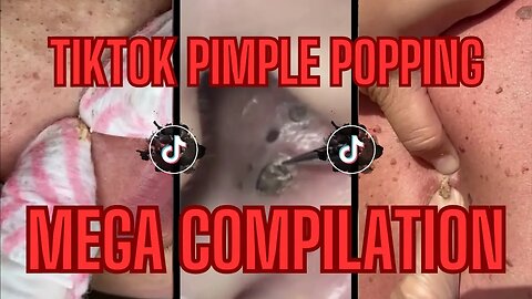 MEGA COMPILATION!!! (1 HOUR LONG) Cysts, Blackheads, AND Pimples | TikTok Pimple Popping Compilation