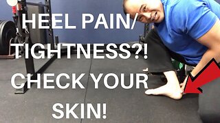 HEEL PAIN/TIGHTNESS?! MISSING ANKLE DORSIFLEXION?! CHECK YOUR SKIN! | Dr Wil & Dr K